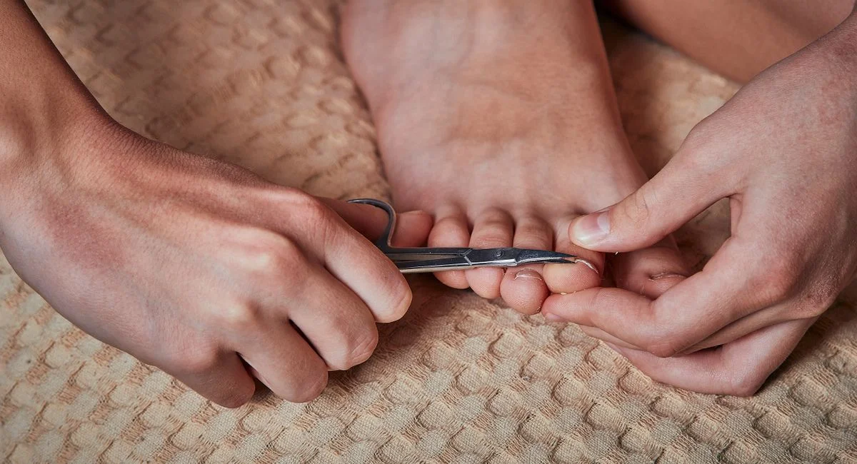 Le jaunissement des ongles des pieds, comment distinguer la mycose d’une simple coloration ?